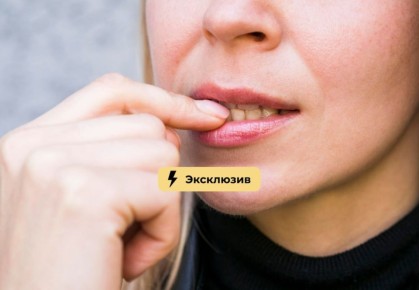 Как избавиться от налета на зубах в домашних условиях